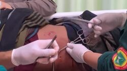 Haripa Warga Pongkeru Berhasil Lolos Dari Serangan Buaya